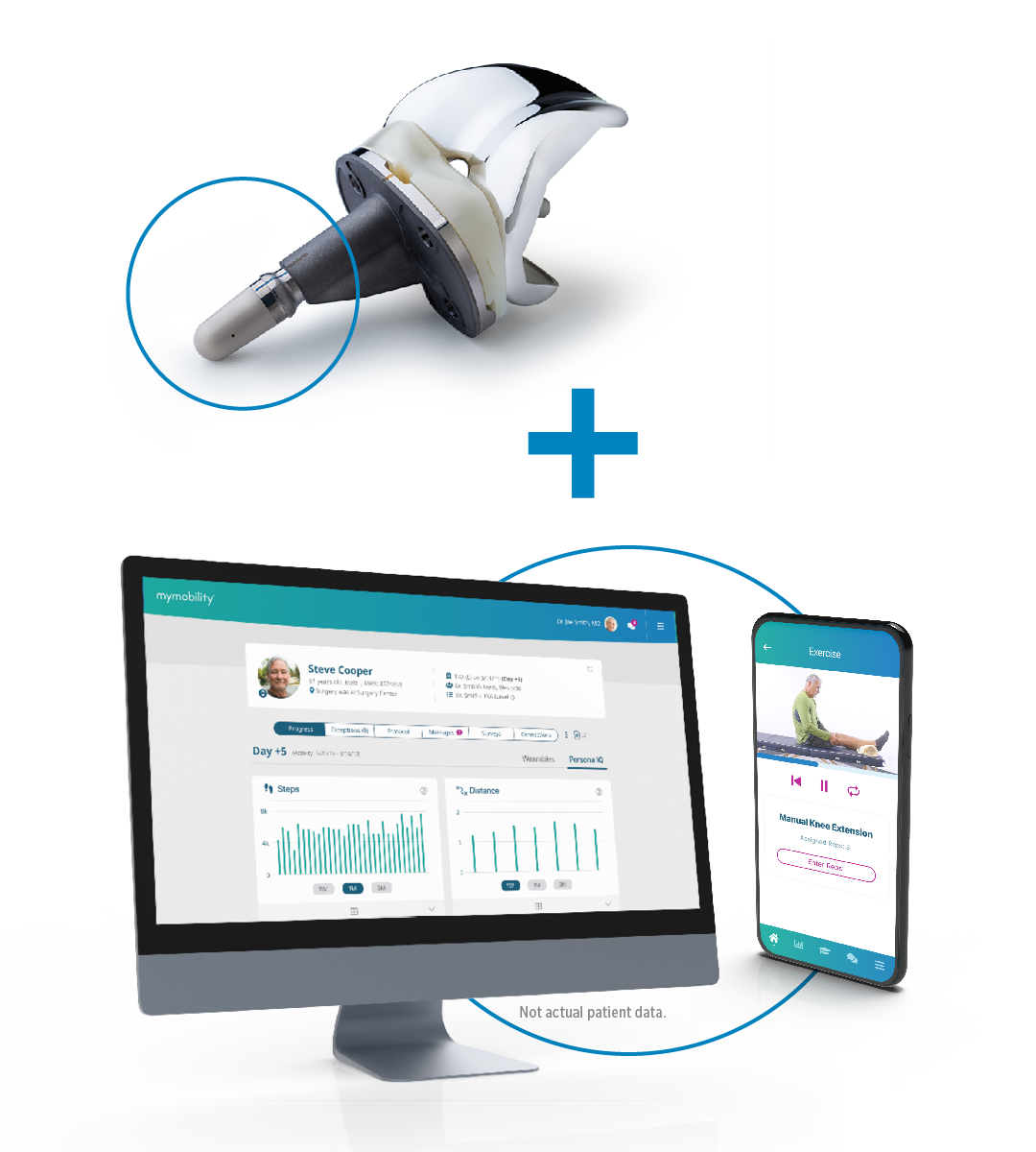 Zimmer Biomet mymobility® and Persona IQ® The Smart Knee®